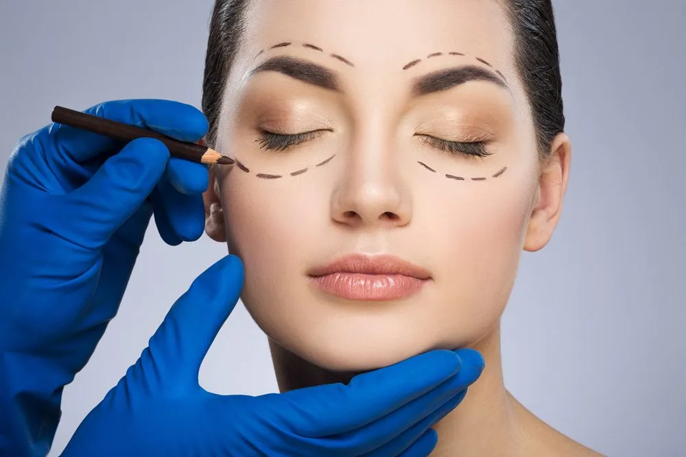 Eyelid Surgery (Blepharoplasty)