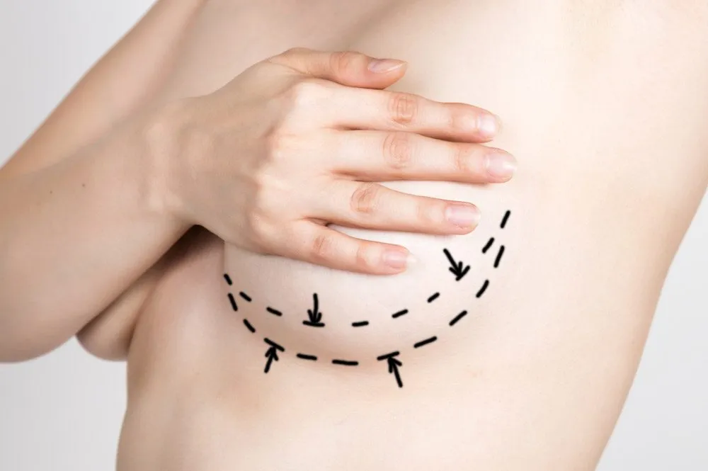 Breast photograph from Dr. Churgin’s website